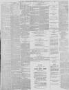 Preston Chronicle Saturday 27 February 1875 Page 7