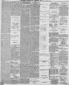 Preston Chronicle Saturday 06 January 1877 Page 5