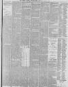Preston Chronicle Saturday 29 March 1879 Page 5
