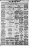 Liverpool Daily Post Tuesday 02 October 1855 Page 1