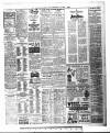 Yorkshire Evening Post Wednesday 01 March 1922 Page 3