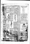 Burnley Express Saturday 10 April 1920 Page 3