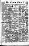 Chester Chronicle Saturday 29 October 1881 Page 1