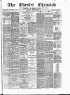 Chester Chronicle Wednesday 12 July 1882 Page 1