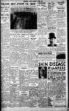Birmingham Daily Gazette Tuesday 02 March 1937 Page 5