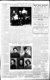Burnley News Saturday 14 August 1915 Page 5