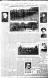 Burnley News Wednesday 18 August 1915 Page 5