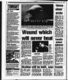 Edinburgh Evening News Saturday 06 March 1993 Page 2