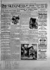 Leicester Daily Mercury Saturday 15 August 1925 Page 9