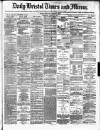 Bristol Times and Mirror Wednesday 21 August 1872 Page 1