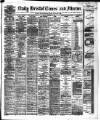 Bristol Times and Mirror Monday 12 December 1881 Page 1