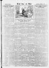 Bristol Times and Mirror Saturday 02 October 1915 Page 13
