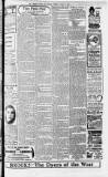 Bristol Times and Mirror Saturday 20 April 1918 Page 11