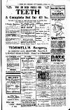 Shipley Times and Express Wednesday 27 August 1913 Page 7