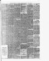 Wigan Observer and District Advertiser Wednesday 02 March 1887 Page 5
