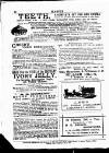 Bristol Magpie Saturday 02 June 1888 Page 21