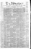 Airdrie & Coatbridge Advertiser Saturday 01 July 1876 Page 1