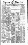 Heywood Advertiser Friday 19 November 1886 Page 1