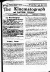 Kinematograph Weekly Thursday 18 April 1918 Page 59