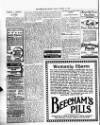 Retford and Worksop Herald and North Notts Advertiser Tuesday 25 March 1919 Page 2