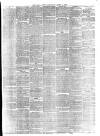 Hull Daily News Saturday 04 April 1874 Page 5