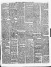 Gateshead Observer Saturday 03 March 1860 Page 3