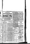 Skegness News Wednesday 24 July 1918 Page 3