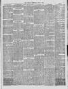 Bolton Journal & Guardian Saturday 10 June 1876 Page 5